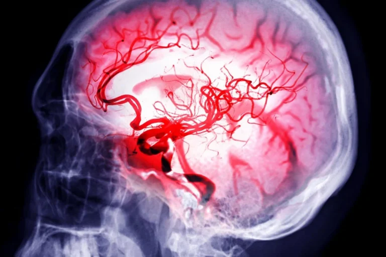 Circadian Reset: Strengthening the Body’s Internal Clock Opens New Window for Post-Stroke Recovery